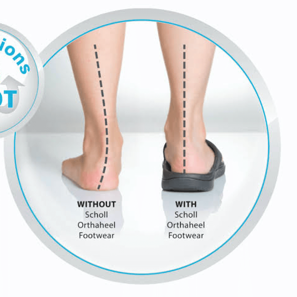 Scholl Orthaheel Men&